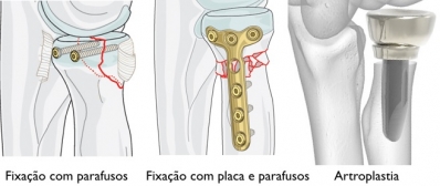 Rádio Cabeça